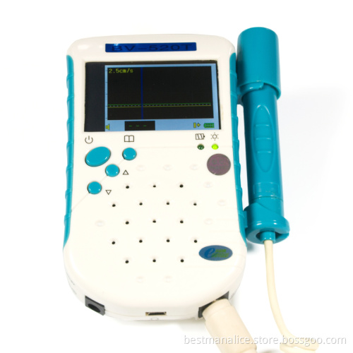 vascular doppler machine